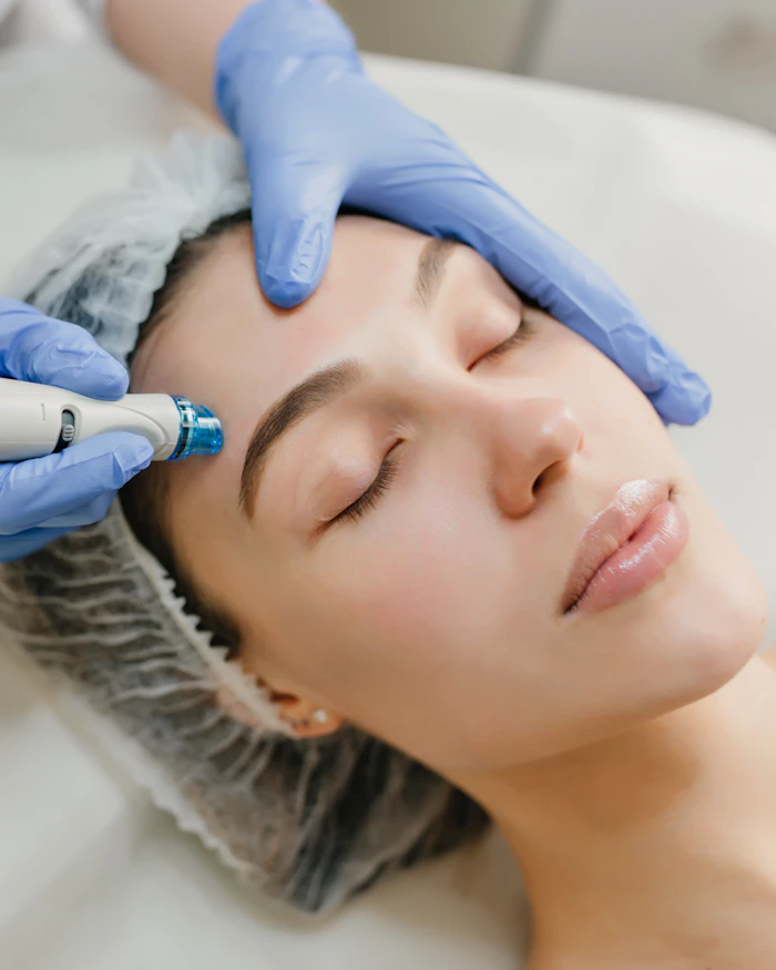 A microneedling device being used during a facial treatment